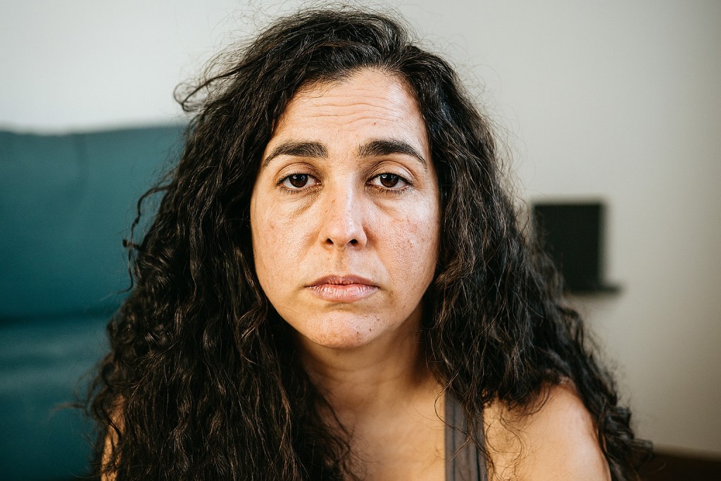 sleep deprivation effects on appearance